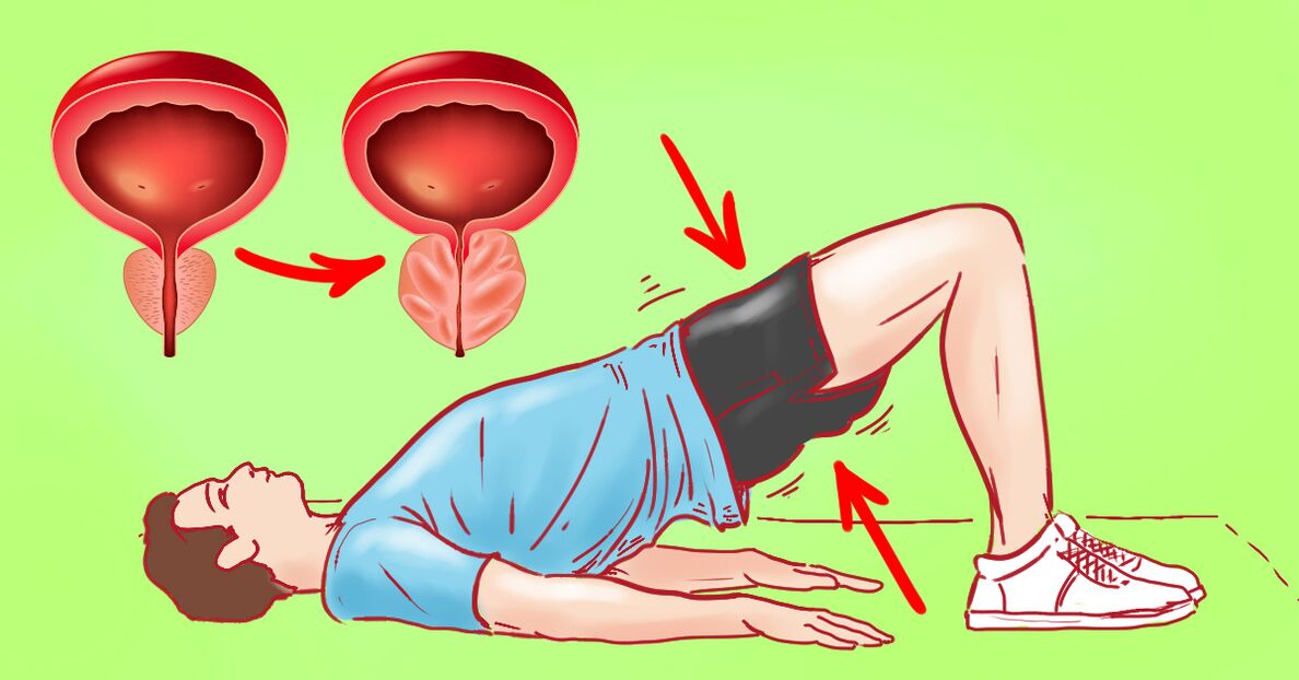 Exerciții terapeutice pentru prostatita cronică